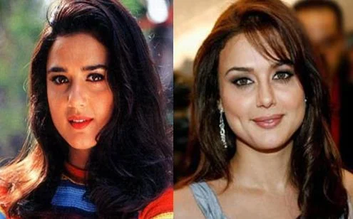 priety Zinta before after nose job