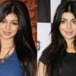 Ayesha Takia before after plastic surgery