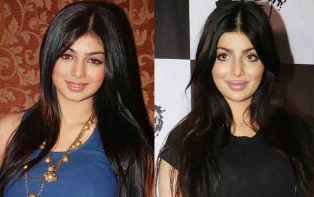 Actresses Before And After Plastic Surgery